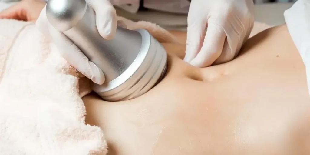 Ultrasonic Cavitation